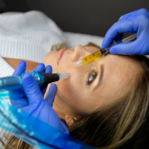 Twilight Facial (microneedling + Natural Growth Factor Injections
