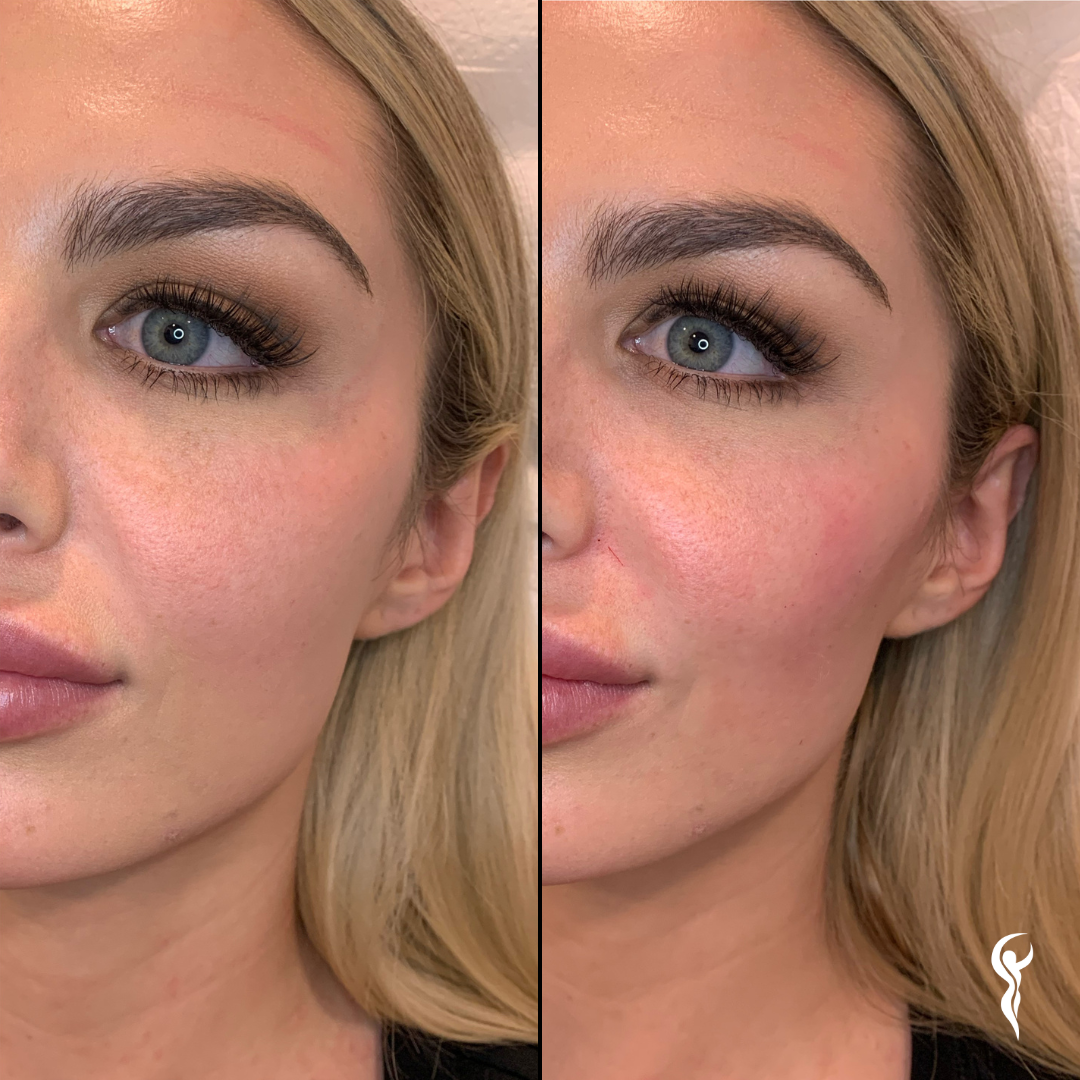Best Before & After (5)