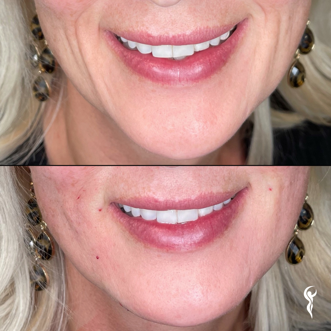 Best Before & After (6)