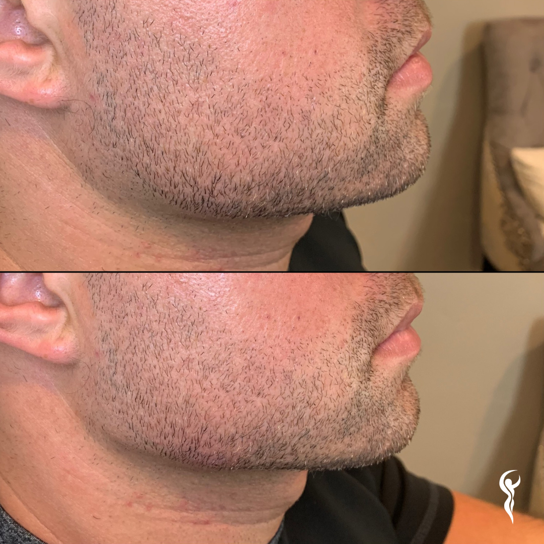 Best Before & After (7)