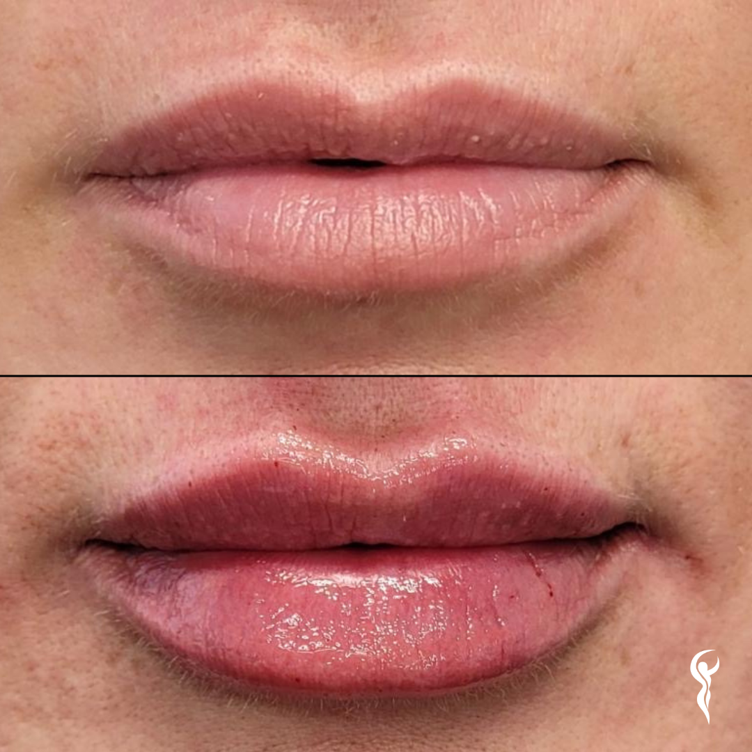 Best Before & After (8)