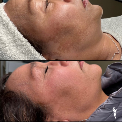 Best Before & After